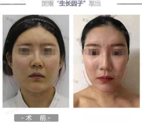 除了电话，还有其他预约大连爱德丽格整形的方式吗？
