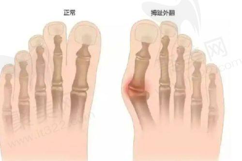 实例三：赵先生的吸脂手术