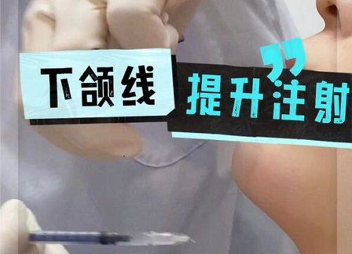 惠州皇佳蝶美医疗美容诊所陈满医生简介