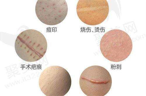 如何通过大连爱德丽格整形预约电话预约刘志刚眼修复？