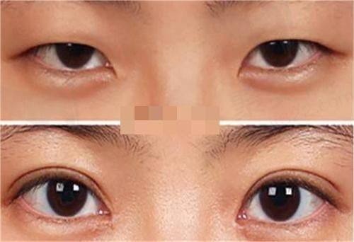 六、广州艺星医疗美容医院科室价格表