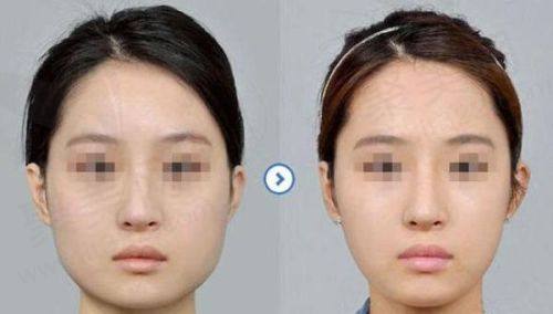 天津美莱医学美容医院口碑好吗？正规连锁品牌医疗实力强服务优难怪口碑出色