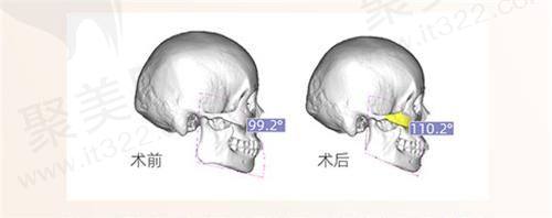 广州艺星医疗美容医院电话400-***-0168，预约挂号轻松便捷，地址天河北路，技术一流，隆胸、鼻综合等项目口碑佳！