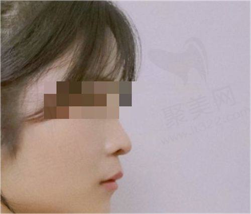 三、济南诺德医疗美容医院口碑如何？患者真实实例分享
