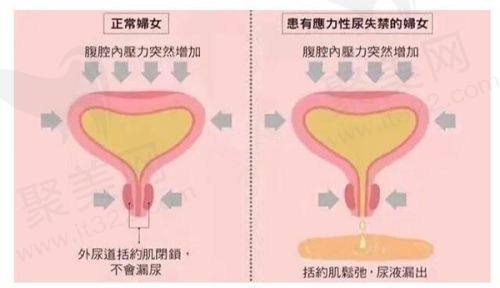 2. 在线弹窗预约