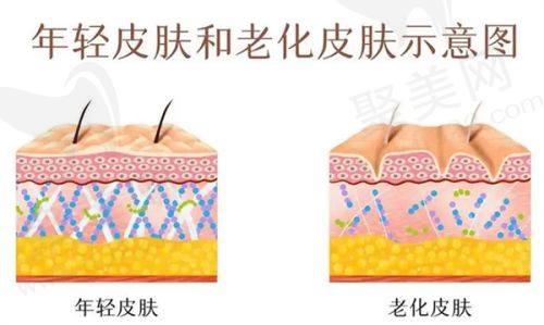 四、双眼皮项目价格明细