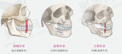 六、济南诺德医疗美容医院的收费标准一览