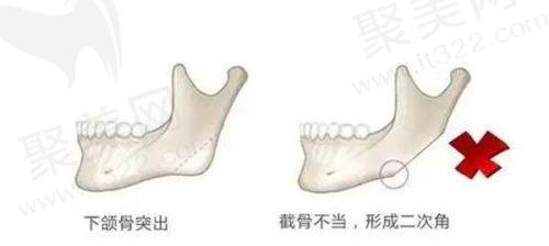 三、成都八大处医院口碑如何？不妨来看集美们的实例评价