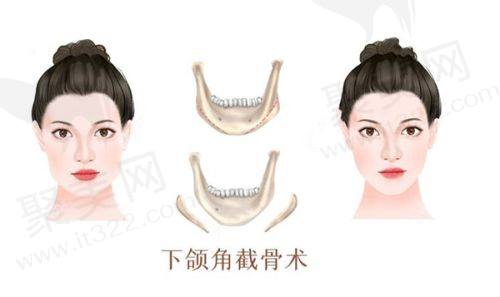 南京友谊整形医院口碑评价如何？医院口碑评测：三甲级别的私立整形医院，安全可靠，值得选择！