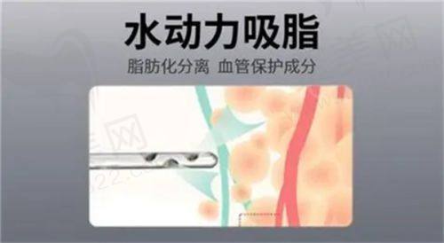 济南诺德医疗美容医院是几级医院？正规的二级整形医院，吸脂隆胸价格透明，在线预约方便快捷