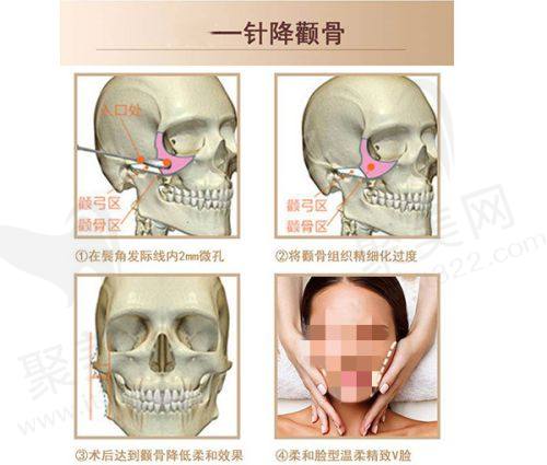 南京医科大学友谊整形外科医院好吗？三甲医院实力与整形项目全面解析