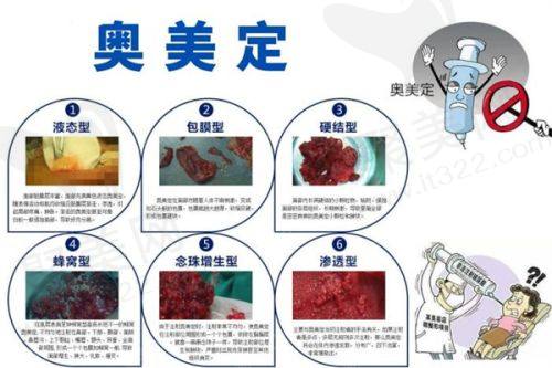三、南京医 科 大学友谊整形医院口碑如何不妨来看集美们的实例评价