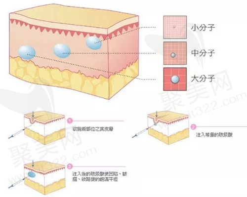 二、广州艺星医疗美容医院在整形项目方面的优势