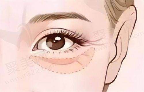 三、南医 大友谊整形医院的口碑如何？不妨来看集美们的实例评价