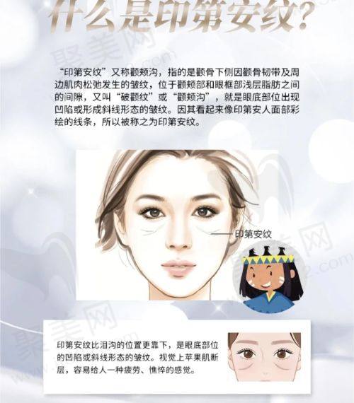 3. 眼部整形项目价格明细