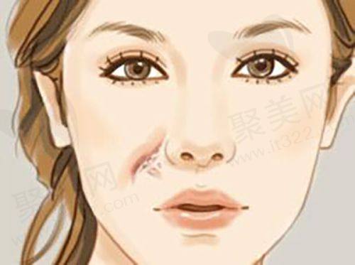 北京艺星医疗美容医院好不好？医院评测：正规认证、医生团队实力与高性价比服务解析
