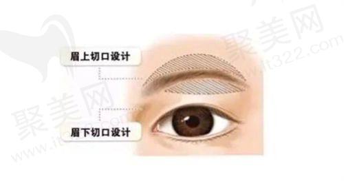 惠州皇佳蝶美医疗美容诊所陈满医生的口碑评价