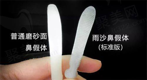 广州艺星和华美哪家好？医院简介/医生技术/口碑评价/收费价格全面对比！