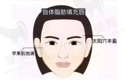 南京友谊整形双眼皮谁做得好？南京友谊医院双眼皮医生推荐：金东勋、高伟成等技术精湛，口碑优秀的整形专家解析