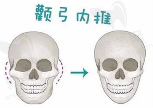 常州新海派苏广美医生擅长项目