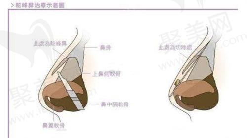 六、南京医科大学友谊整形外科医院医生收费价目表