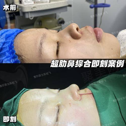 三、西安艺星黄舟医生技术怎么样？