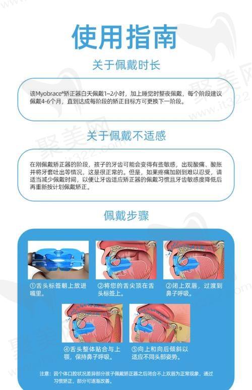 漳州中诺口腔儿童早期矫治的舒适化治疗体验