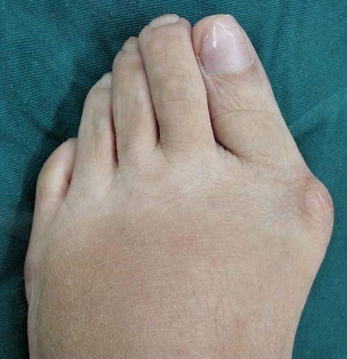 广州艺星医美王雯婷院长注射过程：轻松又舒适