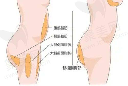 手术方案是如何制定的？