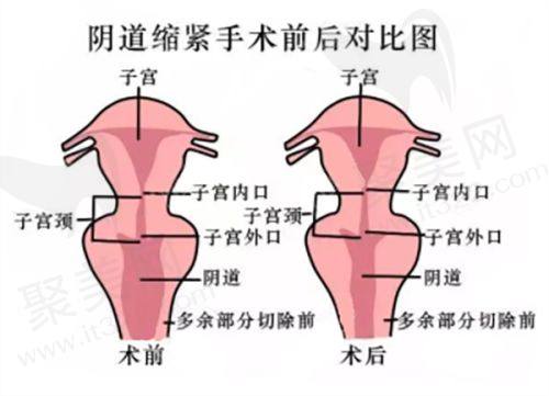 李继华医生在手术安心和术后护理方面表现如何？