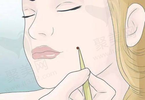 成都八大处侯典举医生面诊体验