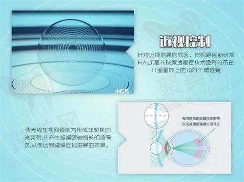 北京希玛林顺潮眼科青光眼手术的优势