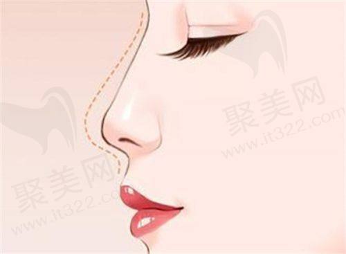 成都八大处王冰清医生简介