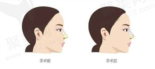 四、广东中山美南华美容医院