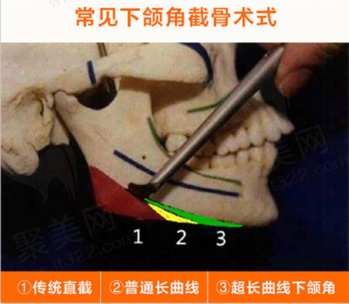 南京秦淮大麦医疗美容诊所预约方式
