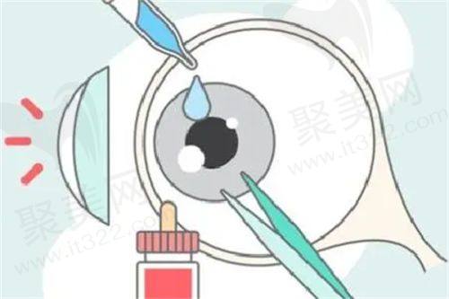 重庆南坪爱尔眼科医院地址、电话、营业时间全公布，快收藏！
