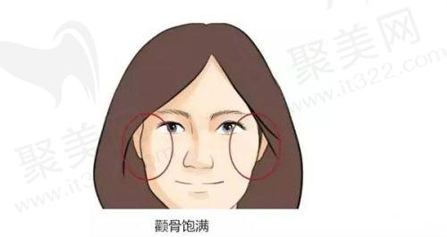 哈尔滨羽禅医美姣兰玻尿酸丰唇的安心保护