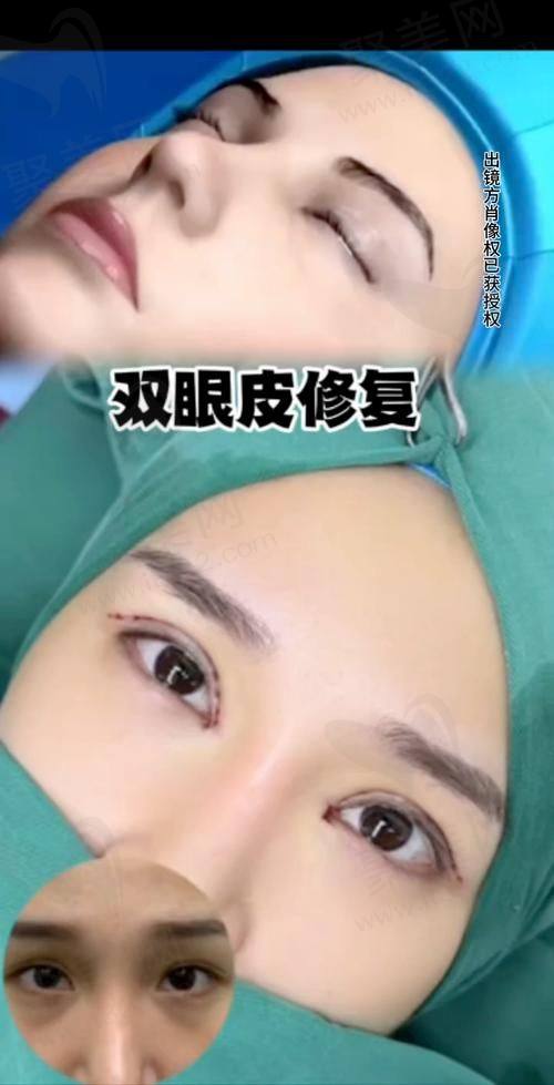 大连爱德丽格整形医院开展项目及价格