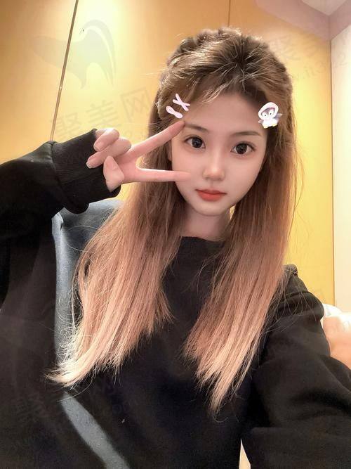 西安西美整形自体软骨隆鼻26800 - 45800元，专业团队塑造自然美鼻