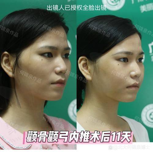 李继华医生的口碑和评价怎么样？