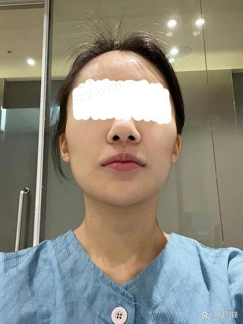 影响李继华颧骨颧弓内推价格的因素