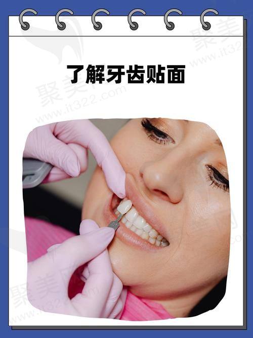 西安团圆口腔半口牙贴面低至1680元/颗起，品质服务与高性价比之选