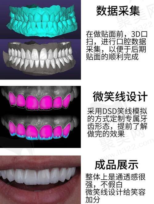 五、西安团圆口腔的其他优势