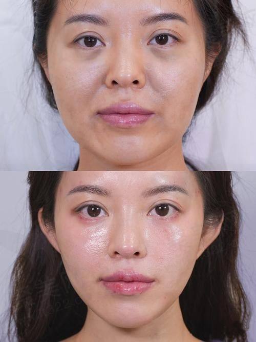 广大医院朴正国医生的真实的患者评价如下：
