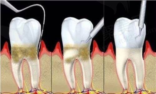 石河子吕媛媛口腔：正规团队打造个性化方案