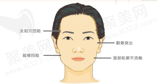 三、李继鹏医生技术怎么样？