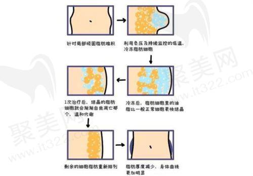 李在郁医生在哪家医院出诊？揭秘北京漾格李医生玻尿酸注射及轮廓固定优势