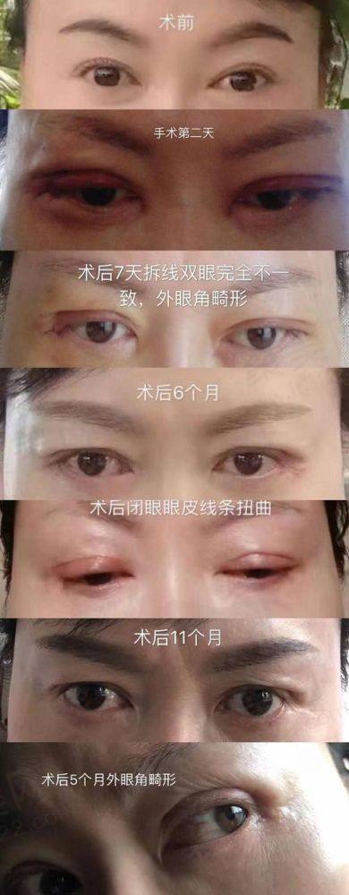 南宁芭芘丽整形的交通便利吗？