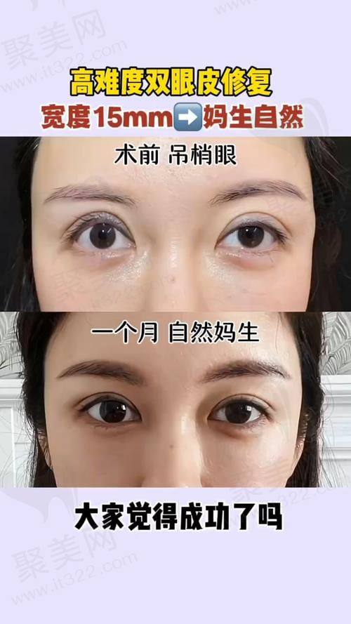 南宁芭芘丽整形是正规机构吗？