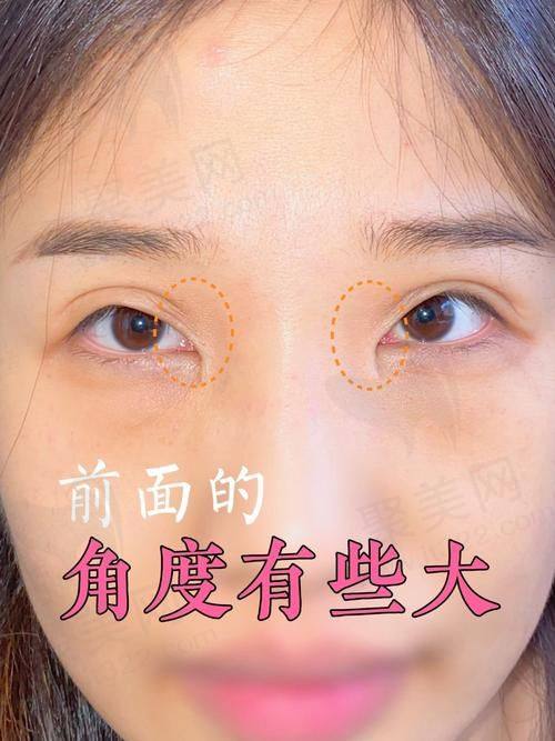 大连爱德丽格王鹤霏医生的真实的患者评价如下：